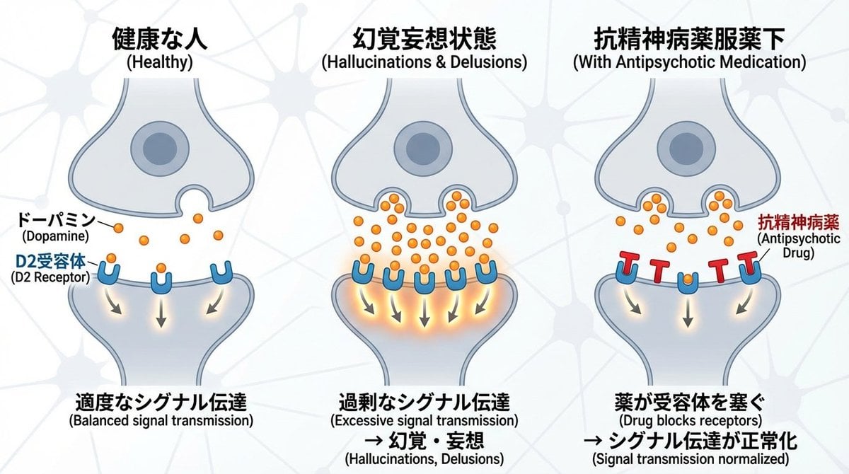 Dopamine and schizophrenia synapse diagram